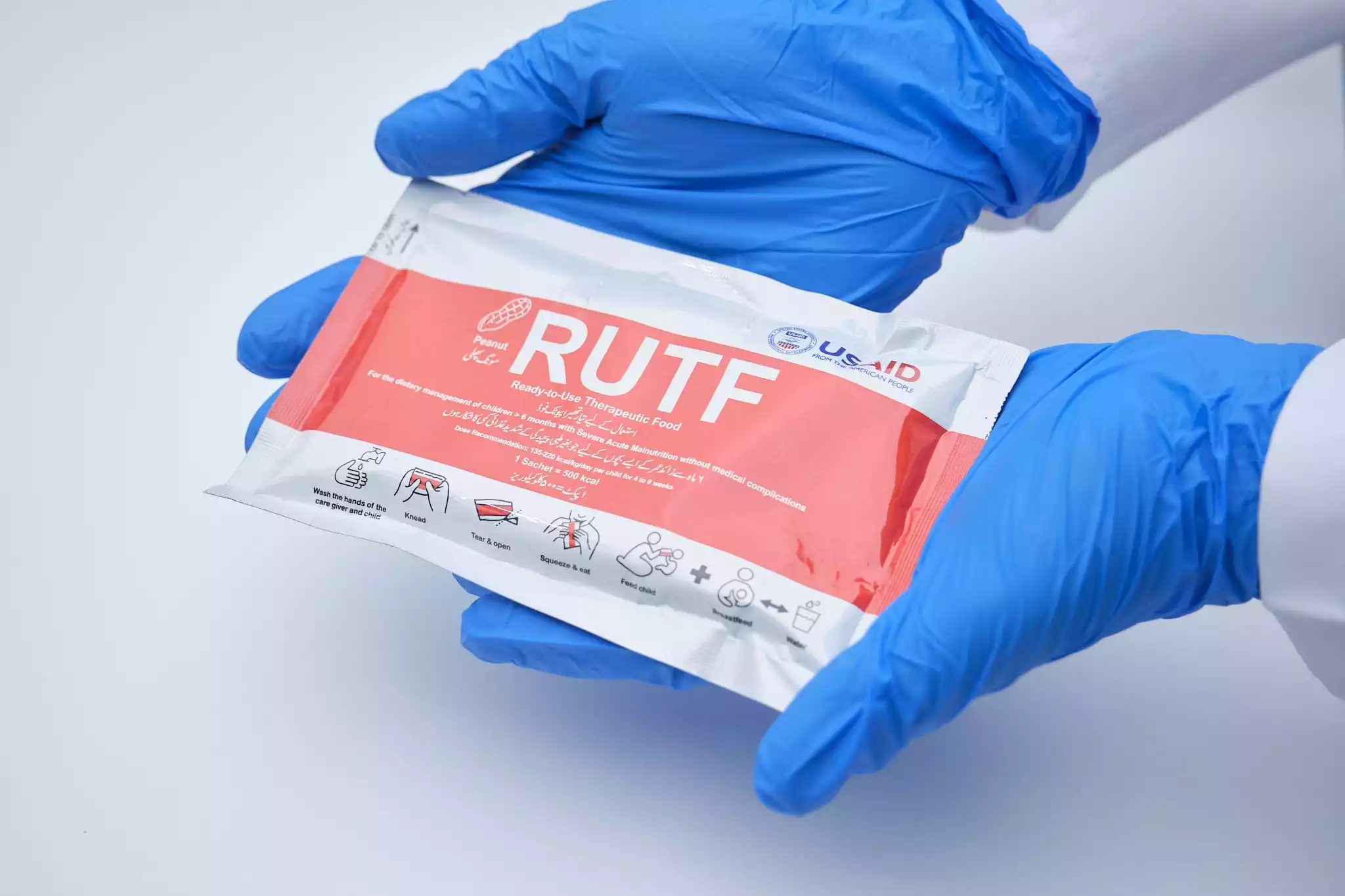 RUTF, RUSF et enrichissement en LNS